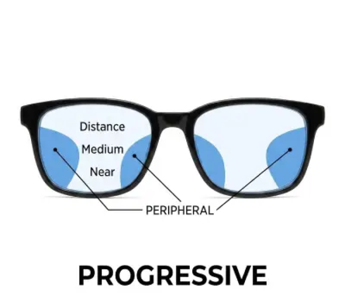 Progressive