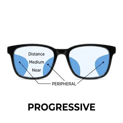 Progressive